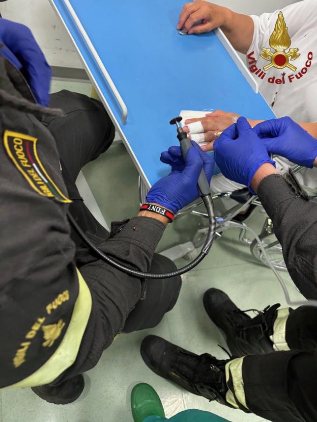 Si frattura alcune dita, per sfilare l'anello arrivano i Vigili del fuoco al Pronto soccorso